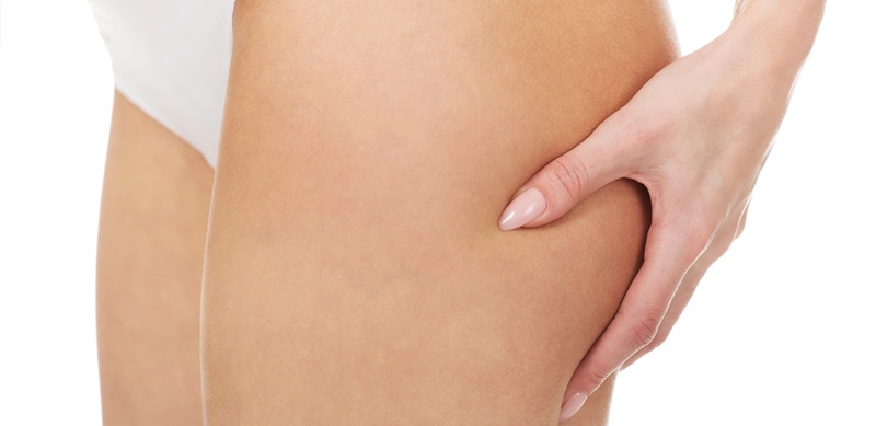 Woman's hand on thigh where many injections are placed