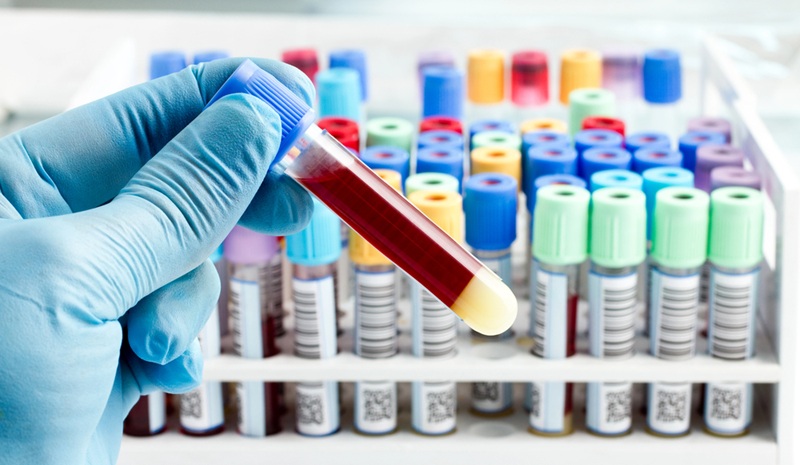 Image of hand holding a sample tube for testing biomarkers in blood
